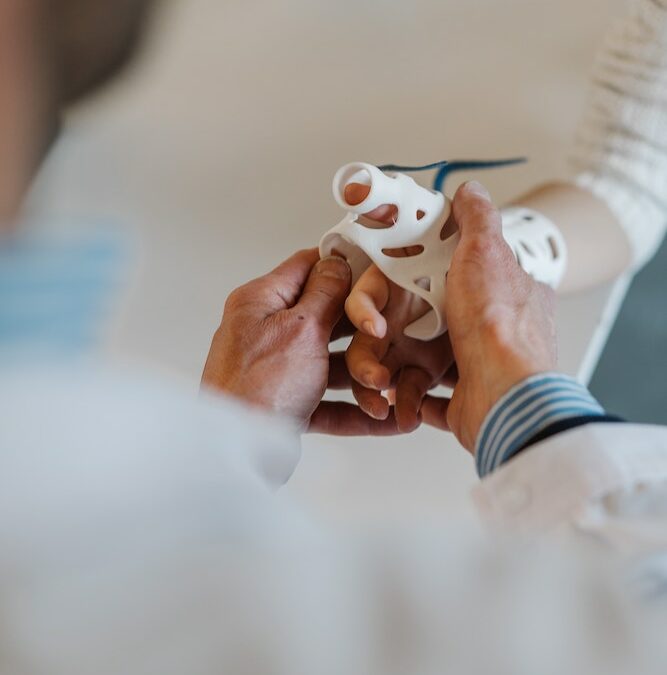 Les prothèses en impression 3D : Une révolution pour le secteur médical